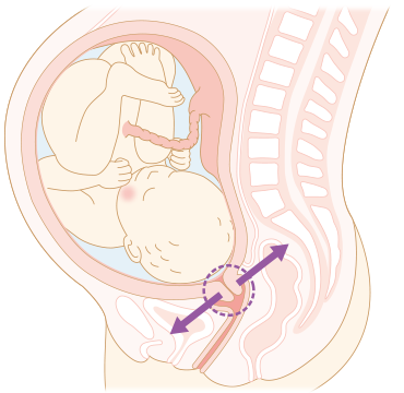  妊娠37週以降の子宮頸管熟化不全の妊婦